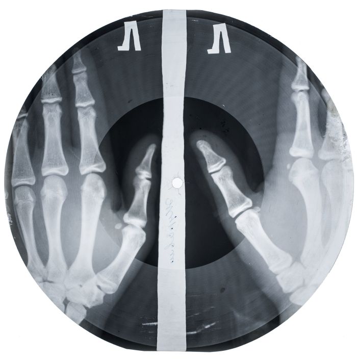 Bill Haley, "Rock Around The Clock" on x-ray film (Photo Courtesy X-Ray Audio, London and The Garage Moscow)